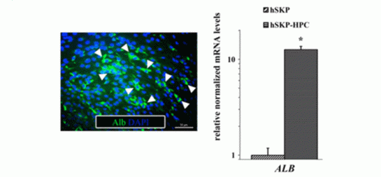 key hepatic protein and major plasma proteins