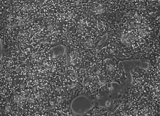 Primary hepatocytes